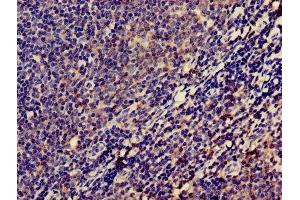 Immunohistochemistry of paraffin-embedded human lymph node tissue using ABIN7158308 at dilution of 1:100 (Leupaxin antibody  (AA 1-300))