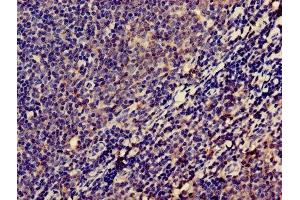 Immunohistochemistry of paraffin-embedded human lymph node tissue using ABIN7158308 at dilution of 1:100