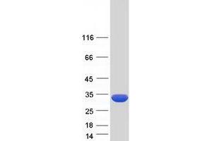 Validation with Western Blot (KCTD1 Protein (Transcript Variant 1) (Myc-DYKDDDDK Tag))