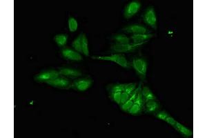 Immunofluorescent analysis of Hela cells using ABIN7153054 at dilution of 1:100 and Alexa Fluor 488-congugated AffiniPure Goat Anti-Rabbit IgG(H+L) (FOXI1 antibody  (AA 183-343))