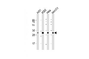 All lanes : Anti-CDK5 Antibody at 1:2000 dilution Lane 1: A431 whole cell lysate Lane 2: K562 whole cell lysate Lane 3: Hela whole cell lysate Lane 4: NIH/3T3 whole cell lysate Lysates/proteins at 20 μg per lane. (CDK5 antibody)