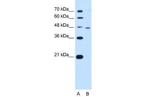 RNF25 antibody used at 0. (RNF25 antibody  (Middle Region))