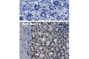 Immunohistochemistry (IHC) image for anti-RAB1A, Member RAS Oncogene Family (RAB1A) (C-Term) antibody (ABIN7272978) (RAB1A antibody  (C-Term))