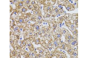 Immunohistochemistry of paraffin-embedded Human liver using GATM Polyclonal Antibody at dilution of 1:100 (40x lens). (GATM antibody)