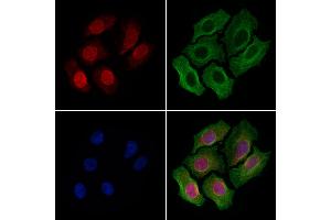 ABIN6263773 and ABIN6279619 staining Hela cells by IF/ICC. (NUP153 antibody  (C-Term))
