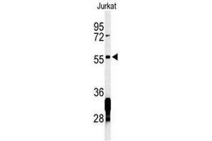 Western blot analysis of RNF8 Antibody in Jurkat cell line lysates (35µg/lane). (RNF8 antibody)
