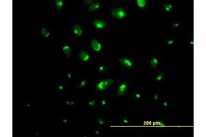 Immunofluorescence of purified MaxPab antibody to ATP2C1 on HeLa cell. (ATP2C1 antibody  (AA 1-919))