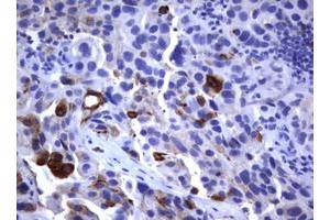 anti-Fc Fragment of IgE, Low Affinity II, Receptor For (CD23) (FCER2) (AA 48-321) antibody