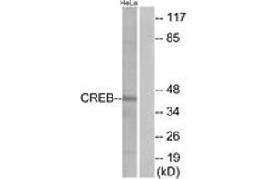 Western blot analysis of extracts from HeLa cells, treated with UV 15', using CREB (Ab-129) Antibody. (CREB1 antibody  (AA 96-145))