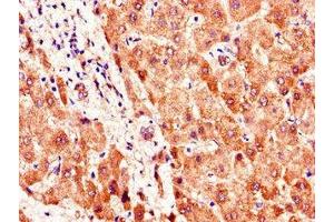 Immunohistochemistry of paraffin-embedded human liver tissue using ABIN7169898 at dilution of 1:100 (SMO antibody  (AA 28-233))