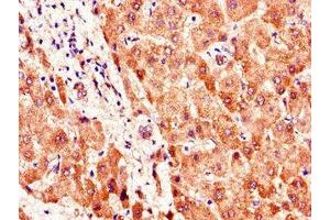 Immunohistochemistry of paraffin-embedded human liver tissue using ABIN7169898 at dilution of 1:100