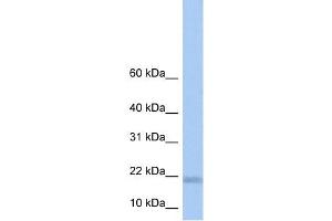 LOC284009 antibody used at 1 ug/ml to detect target protein. (LOC284009 antibody  (N-Term))