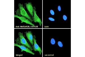 (ABIN185658) Immunofluorescence analysis of paraformaldehyde fixed HeLa cells, permeabilized with 0. (GRIN2B antibody  (Internal Region))