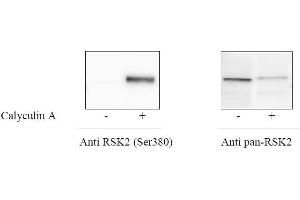 HeLa cells were treated or untreated with Calyculin A. (ATF2 ELISA Kit)