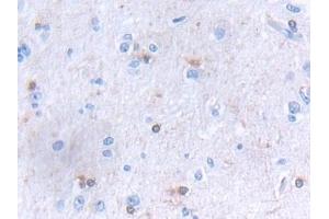 Detection of GLTP in Human Cerebrum Tissue using Polyclonal Antibody to Glycolipid Transfer Protein (GLTP) (GLTP antibody  (AA 2-209))