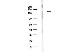 anti-FYN-Binding Protein (FYB) antibody
