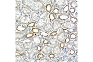Immunohistochemistry of paraffin-embedded rat kidney using DC Rabbit mAb (ABIN7266685) at dilution of 1:200 (40x lens). (DCAF7 antibody)
