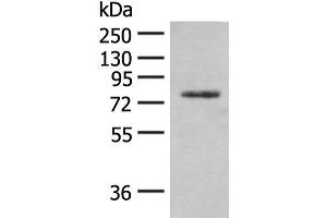 Western blot analysis of Hela cell lysate using TRMT1 Polyclonal Antibody at dilution of 1:300 (TRMT1 antibody)