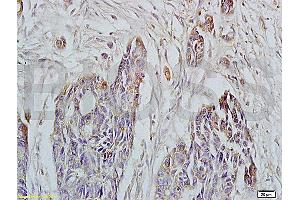 Immunohistochemistry (IHC) image for anti-HLA Class I Histocompatibility Antigen, alpha Chain E (HLA-E) (AA 251-358) antibody (ABIN674334) (HLA-E antibody  (AA 251-358))