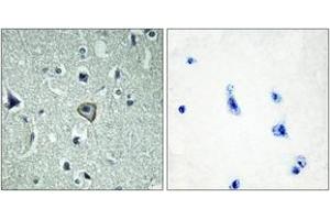 Immunohistochemistry analysis of paraffin-embedded human brain tissue, using BAI2 Antibody. (BAI2 antibody  (AA 91-140))