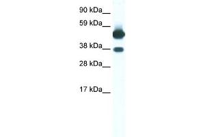 WB Suggested Anti-THRB Antibody Titration:  0. (THRB antibody  (N-Term))