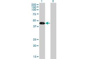 Western Blot analysis of ZNF3 expression in transfected 293T cell line by ZNF3 monoclonal antibody (M08), clone 1F7.