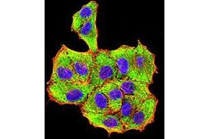 Immunocytochemistry (ICC) image for anti-VP2 (AA 296-438) antibody (ABIN5862415) (VP2 (AA 296-438) antibody)