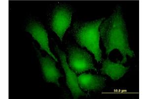 Immunofluorescence of monoclonal antibody to MAPK3 on HeLa cell. (ERK1 antibody  (AA 279-379))