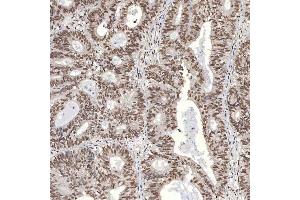 IHC analysis of U1A/SNRPA using anti-U1A/SNRPA antibody (ABIN7600891). (SNRPA1 antibody  (AA 25-218))