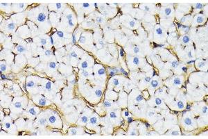 Immunohistochemistry of paraffin-embedded Human liver using NT5E / CD73 Polyclonal Antibody at dilution of 1:200 (40x lens). (CD73 antibody)