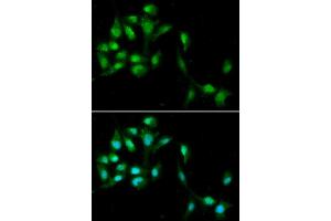 Immunofluorescence analysis of A549 cell using HEXIM1 antibody. (HEXIM1 antibody)