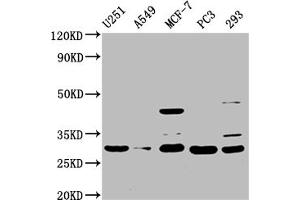Western Blot Positive WB detected in: U251 whole cell lysate, A549 whole cell lysate, MCF-7 whole cell lysate, PC-3 whole cell lysate, 293 whole cell lysate All lanes: REEP4 antibody at 1:1500 Secondary Goat polyclonal to rabbit IgG at 1/50000 dilution Predicted band size: 30, 20 kDa Observed band size: 30 kDa (Receptor Accessory Protein 4 antibody  (AA 78-257))