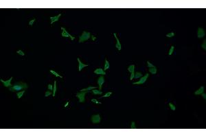 Detection of IL18 in Human HepG2 cell using Monoclonal Antibody to Interleukin 18 (IL18) (IL-18 antibody  (AA 37-193))