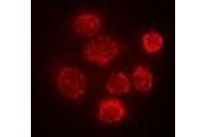 Immunofluorescent analysis of SBP-2 staining in Hela cells. (SECISBP2 antibody)