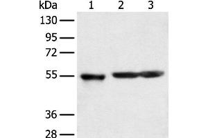 Western blot analysis of Human cerebrum tissue rat brain tissue and Mouse brain tissue using KCTD16 Polyclonal Antibody at dilution of 1:350 (KCTD16 antibody)