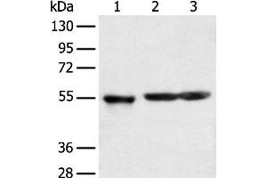 Western blot analysis of Human cerebrum tissue rat brain tissue and Mouse brain tissue using KCTD16 Polyclonal Antibody at dilution of 1:350