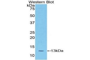 Detection of Recombinant S100A4, Mouse using Polyclonal Antibody to S100 Calcium Binding Protein A4 (S100A4) (s100a4 antibody  (AA 1-101))