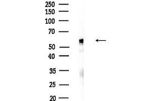 anti-Raftlin, Lipid Raft Linker 1 (RFTN1) (Internal Region) antibody