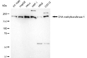 Western blotting analysis using DNA methyltransferase 1 antibody (ABIN7798362). (Recombinant DNMT1 antibody)