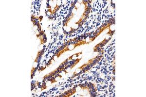 Immunohistochemical analysis of paraffin-embedded H. (SHB antibody  (AA 250-290))