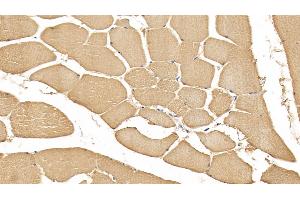 Detection of RNLS in Human Skeletal muscle Tissue using Monoclonal Antibody to Renalase (RNLS) (RNLS antibody  (AA 18-342))