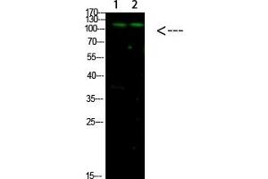 Western Blot analysis of 1, Mouse-liver 2, hela cells using primary antibody diluted at 1:1000 (4 °C overnight). (GLI1 antibody  (AA 460-490))