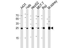 Western blot analysis of lysates from A431, Hela, HepG2, MCF-7, Raji cell line and mouse kidney tissue lysate (from left to right), using AK4 Antibody (Center) (ABIN1944856 and ABIN2838526). (AK4 antibody  (AA 119-153))