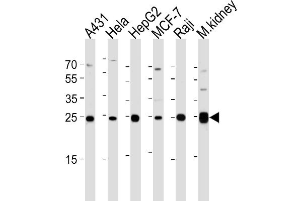 AK4 Antikörper  (AA 119-153)