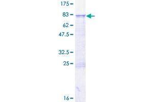 RNMTL1 Protein (AA 1-420) (GST tag)