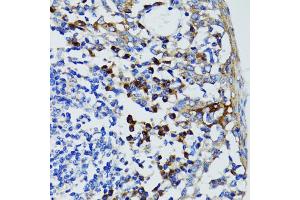 Immunohistochemistry of paraffin-embedded human tonsil using USO1 antibody (ABIN1875291) at dilution of 1:100 (40x lens). (USO1 antibody)