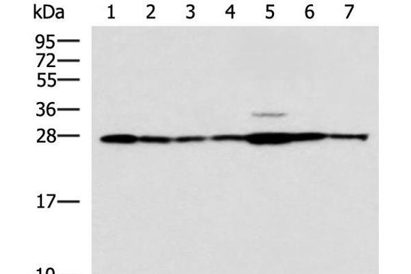 RPL10A antibody