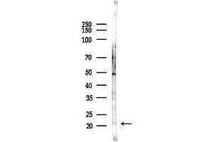 Western blot analysis of lysates from COLO205 cells(heat-shock,45 min treatment), using Phospho-p21 Cip1 (Thr145) Antibody at 1/1000 dilution.