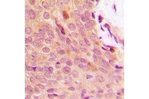 Immunohistochemistry (IHC) image for anti-Nuclear Factor of kappa Light Polypeptide Gene Enhancer in B-Cells Inhibitor, alpha (NFKBIA) (N-Term), (pTyr42) antibody (ABIN7303932)