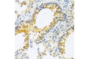 Immunohistochemistry of paraffin-embedded mouse lung using IL20 antibody at dilution of 1:100 (40x lens).